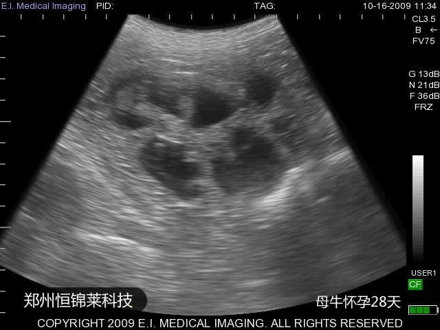 母牛28天妊娠B超图
