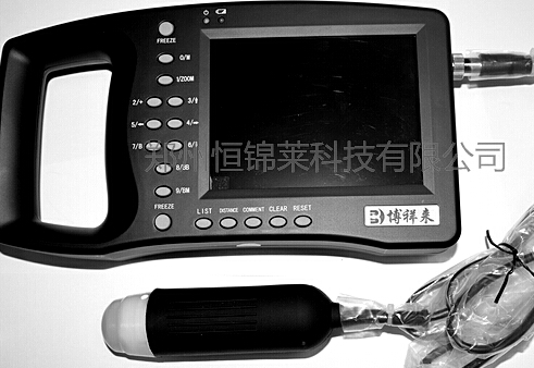 准确率高的背膘测定仪