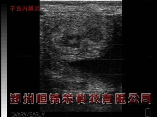 母牛子宫内膜炎B超图像