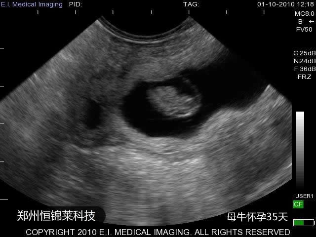 母牛怀孕35天B超图像