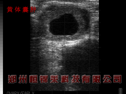 进口牛用B超机检查奶牛黄体囊肿