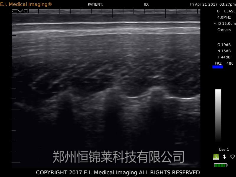 进口母猪B超机检测背膘B超图像