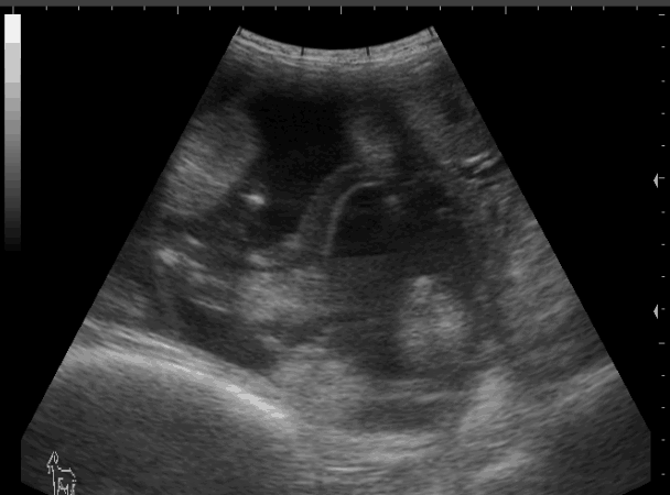 羊用B超仪观察母羊妊娠B超图像