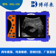 高清兽用B超机BXL-V50牛用测孕仪