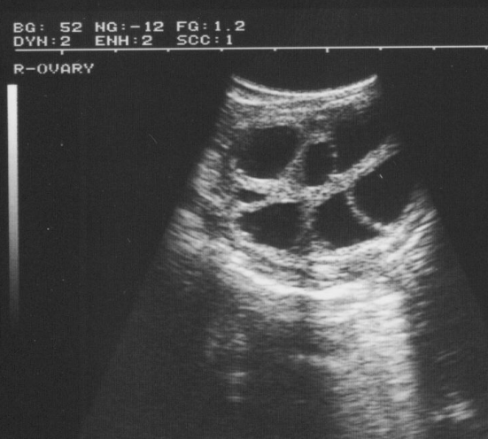 高清牛用B超机妊娠检测