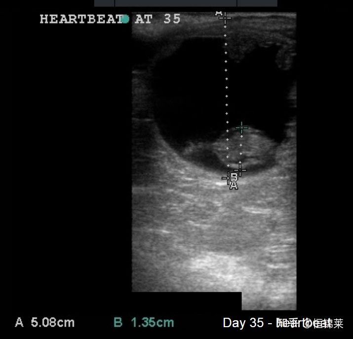 兽用B超仪检测马妊娠超声图像