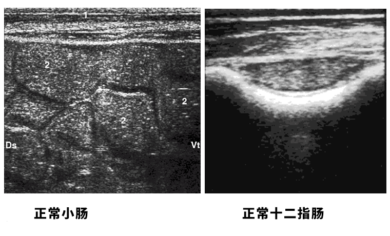 牛用B超检测牛的小肠