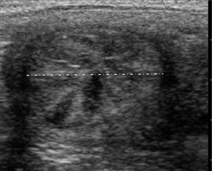 马子宫角发情横截面