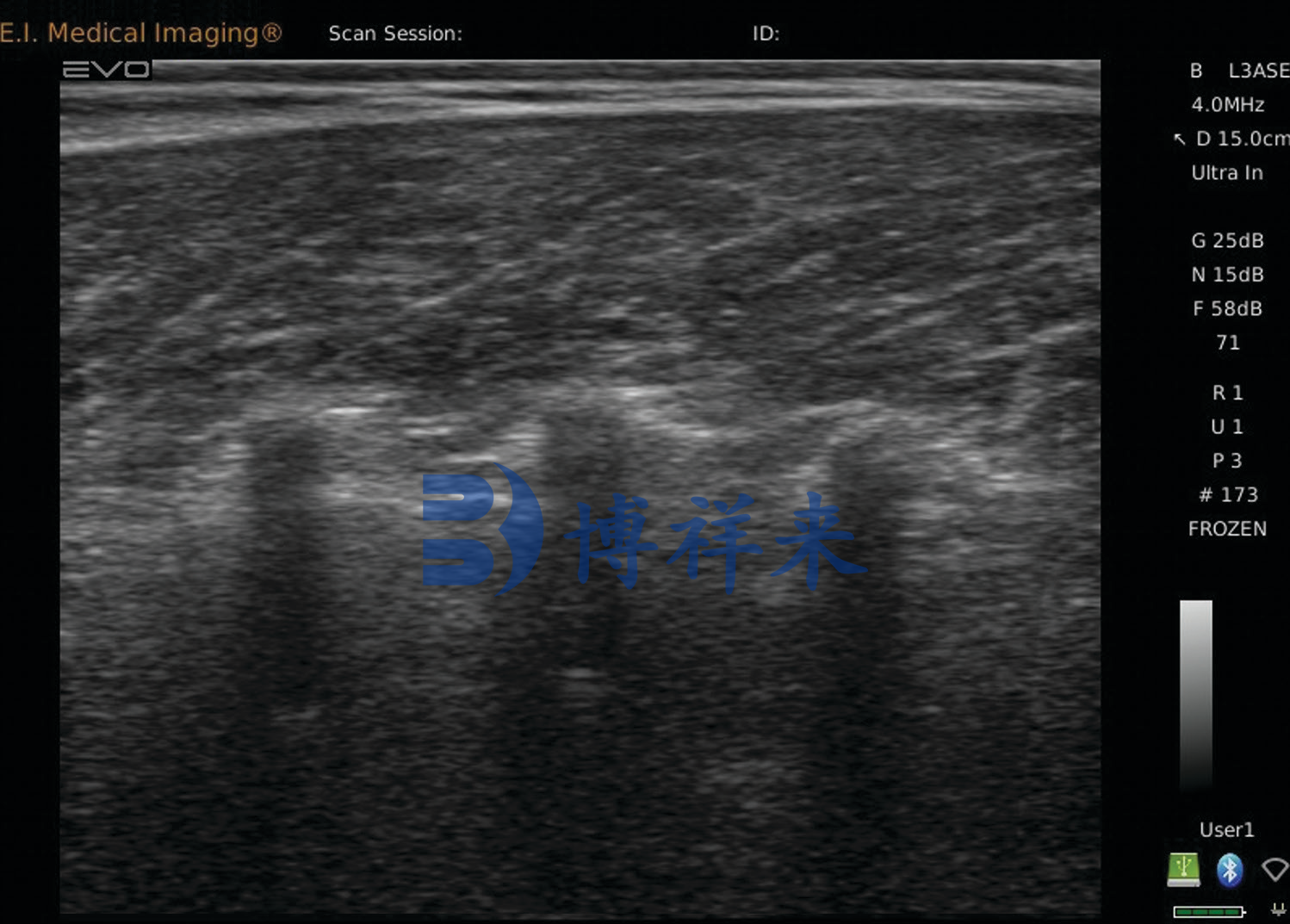肉牛机内脂肪超声 大理石花纹