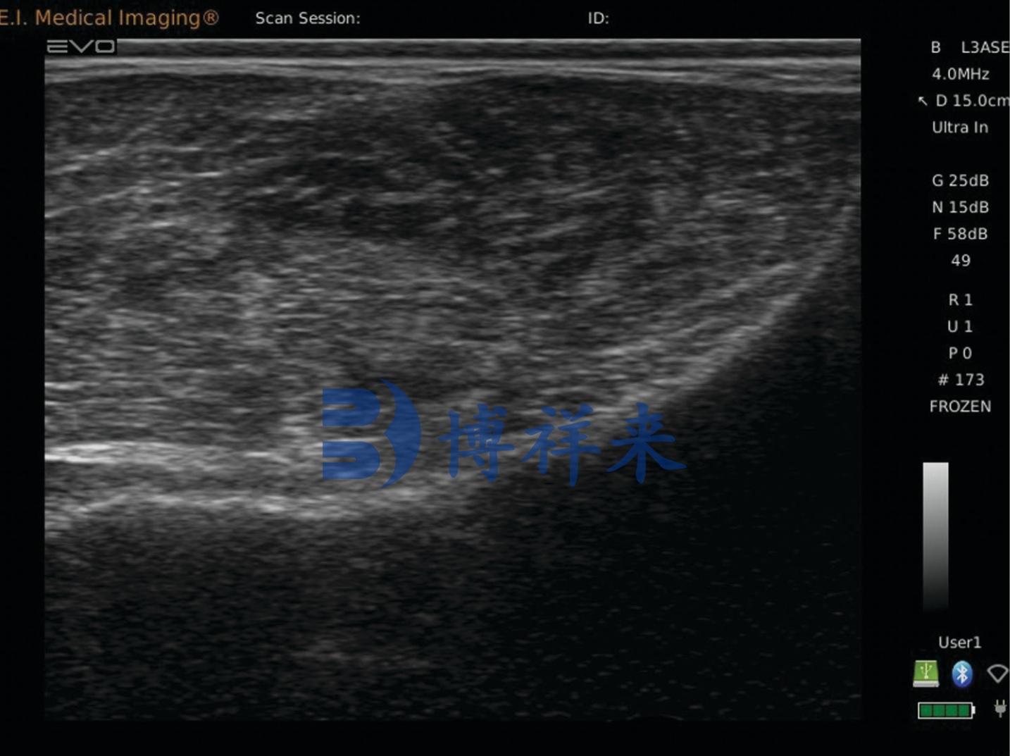 牛臀部脂肪超声图像