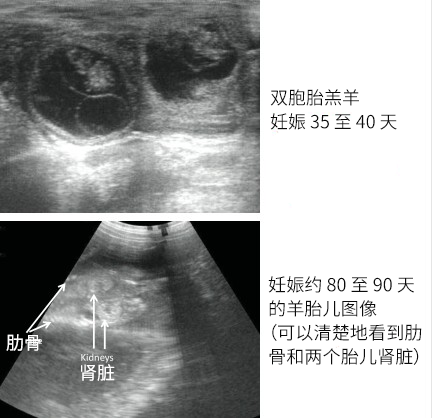 双胎羊B超