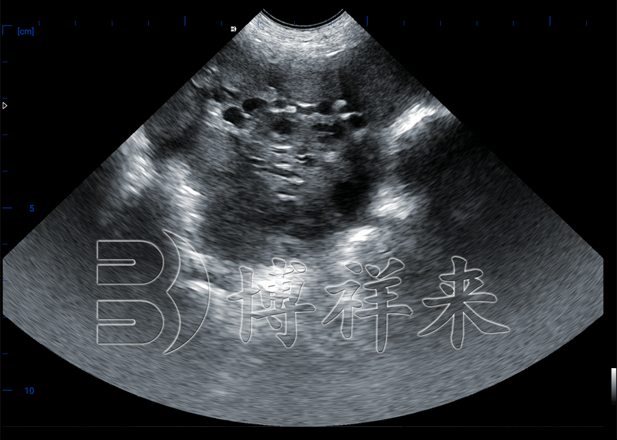 B超机测母猪卵泡发育