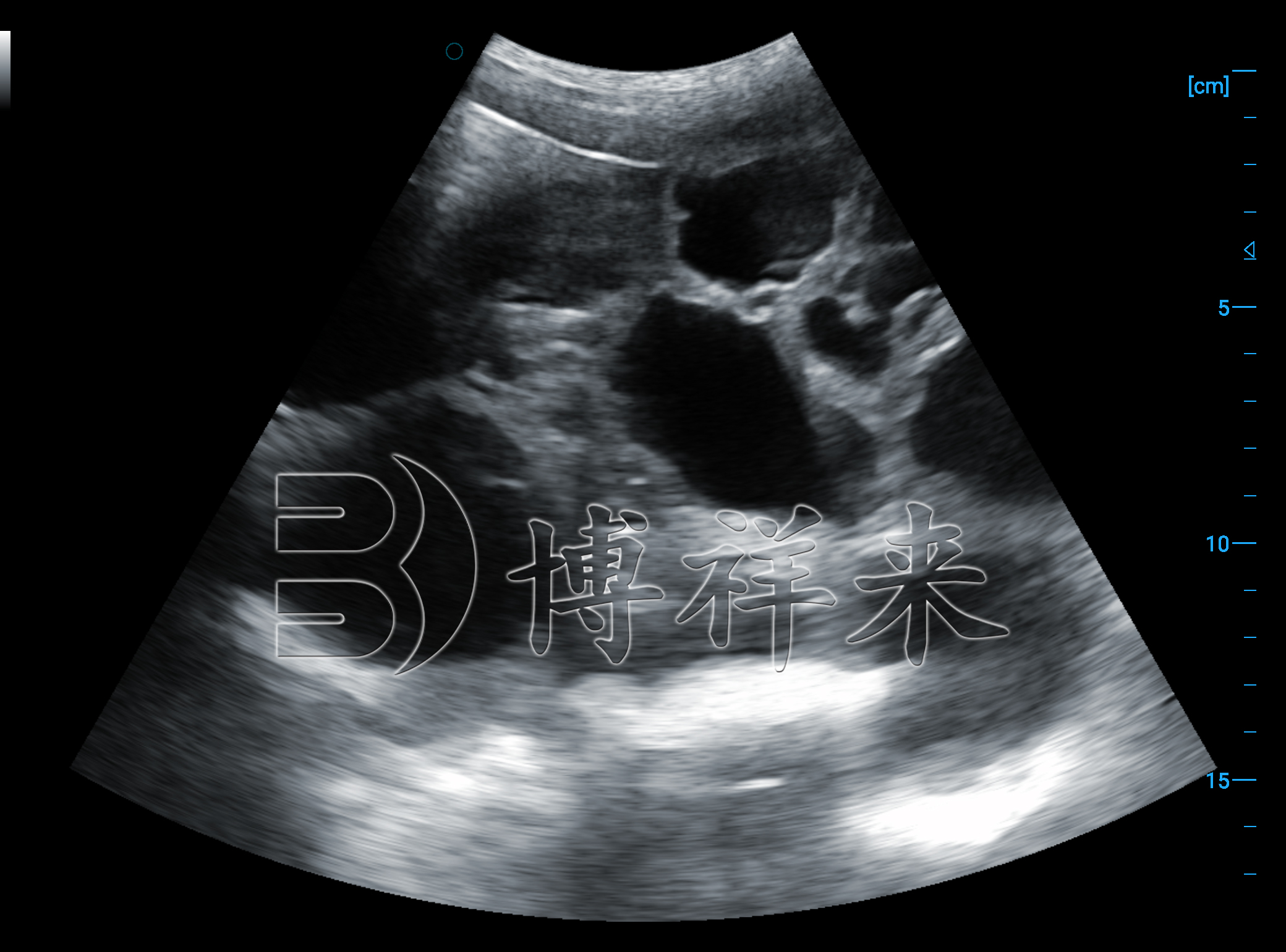 兽用B超仪母猪怀孕超声图