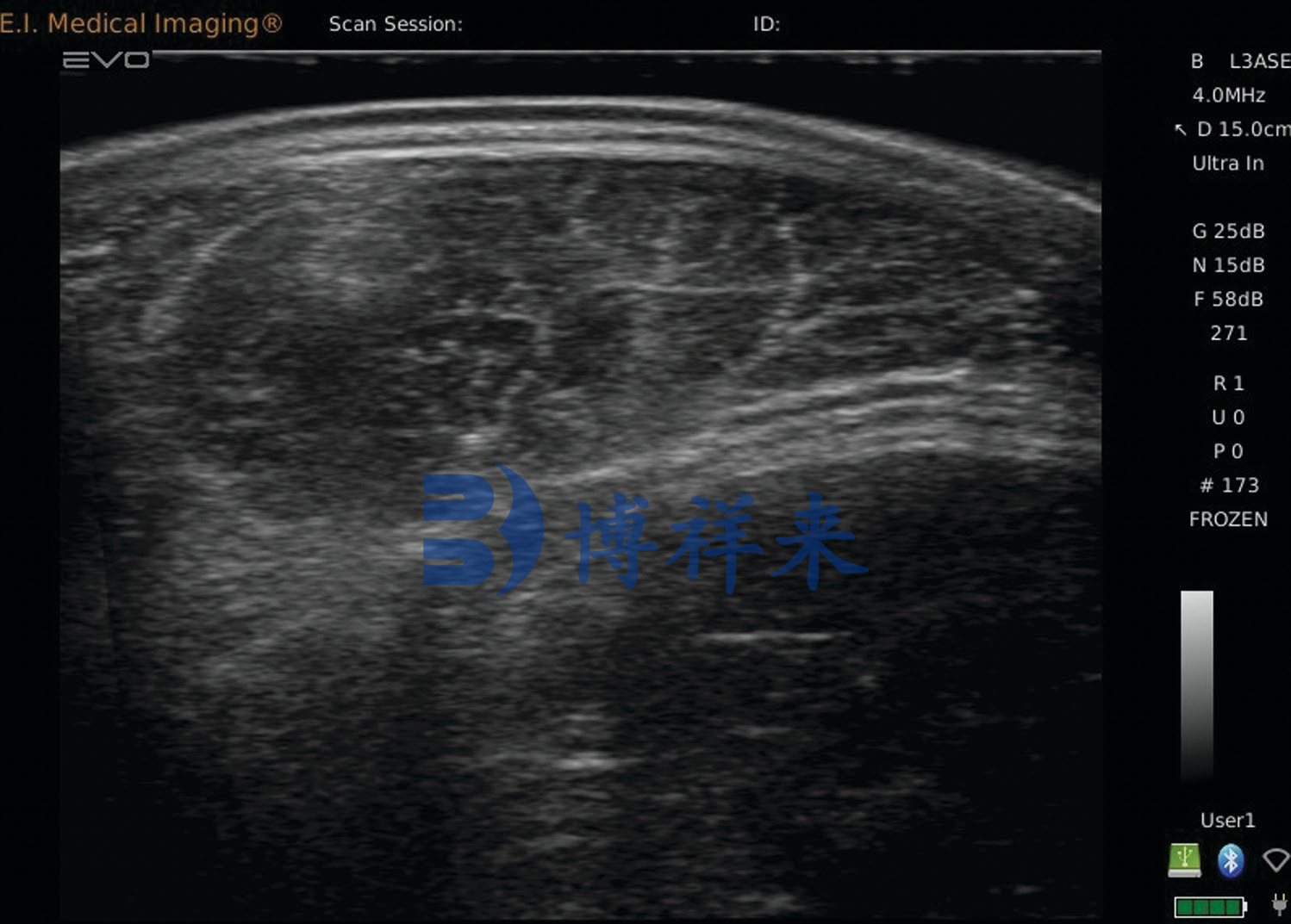 高清肉牛眼肌面积测定仪